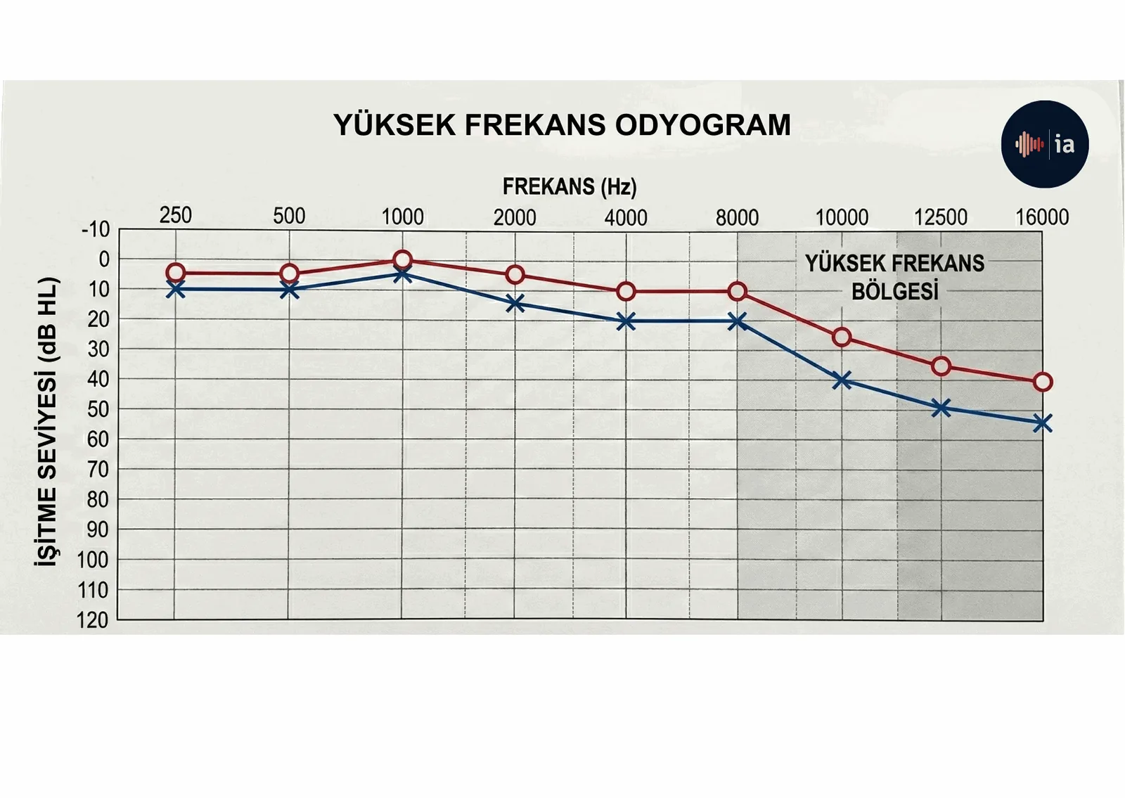 Yüksek frekans odyogram örneği