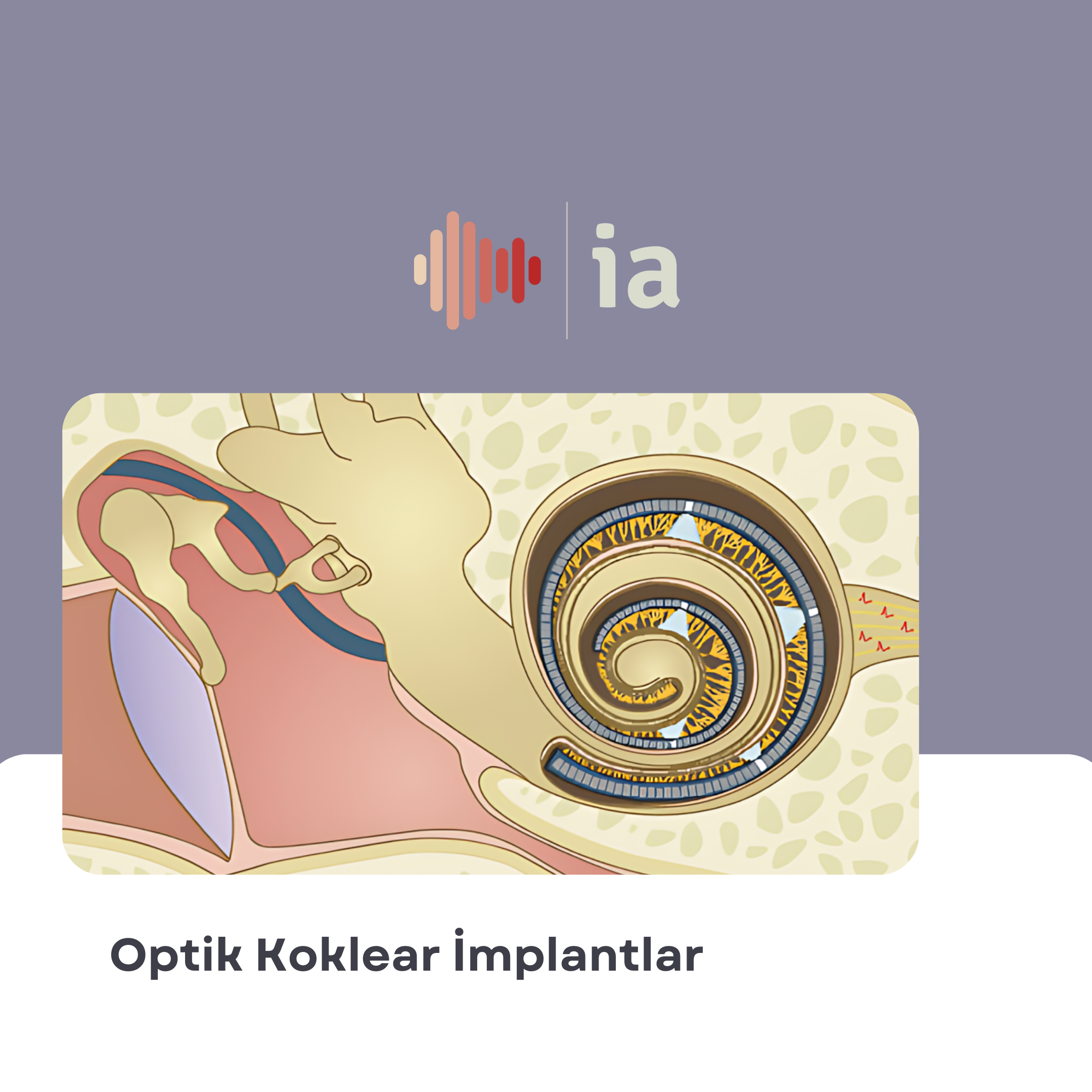 Optik Koklear İmplantlar: İşitme Teknolojisinde Bir Devrim